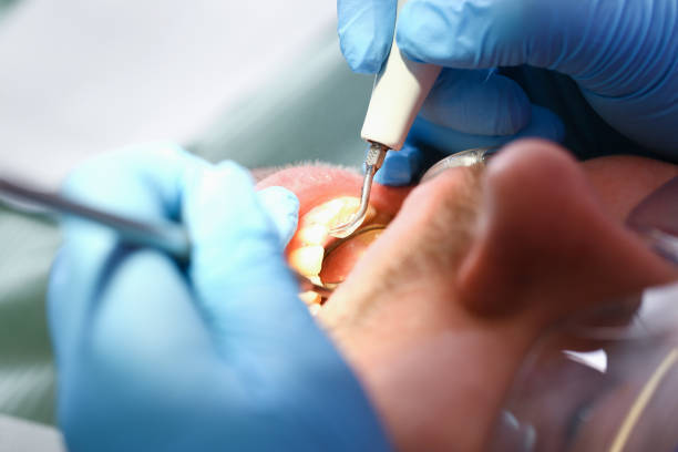 Best Emergency Dental Care for Broken or Chipped Teeth in Skidway Lake, MI