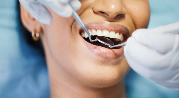 Best Emergency Root Canal Treatment in Skidway Lake, MI