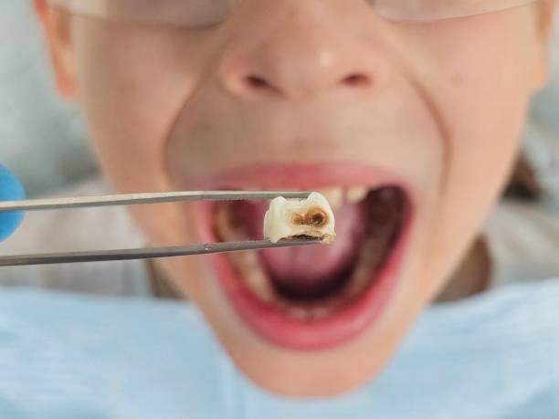 Best Emergency Gum Treatment in Skidway Lake, MI